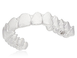 インビザライン