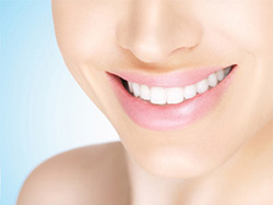 ホワイトニング